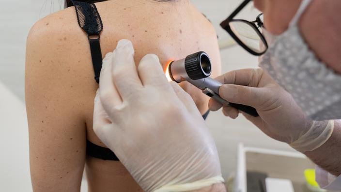Dermatologist’s appointment, dermatologist performs dermatoscopy